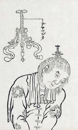 trypanon|what is trepanation used for.